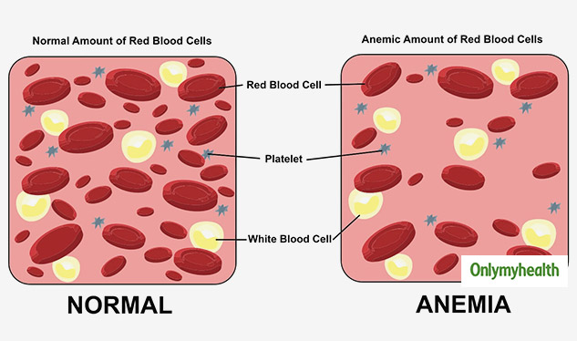 anaemic during pregnancy