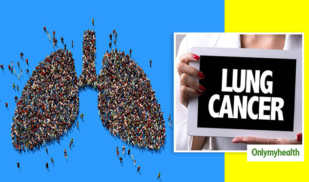 is-lung-cancer-curable-in-early-stages-curable-expectancy