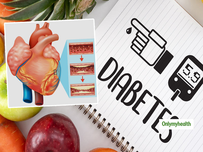 Can Diabetes Lead To A Four-Fold Increase In Coronary Artery Disease? 