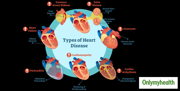 Can Diabetes Lead To A Four-Fold Increase In Coronary Artery Disease ...