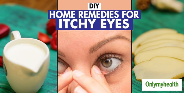 Itchy Eyes Dont Rub Them Try These Home Remedies Onlymyhealth 