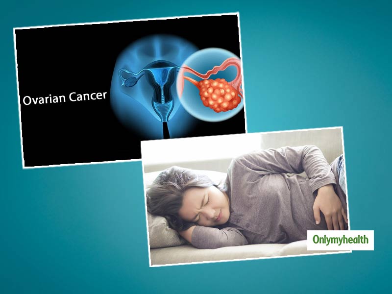 Ovarian Cancer: Causes, Symptoms, Diagnosis And Treatment