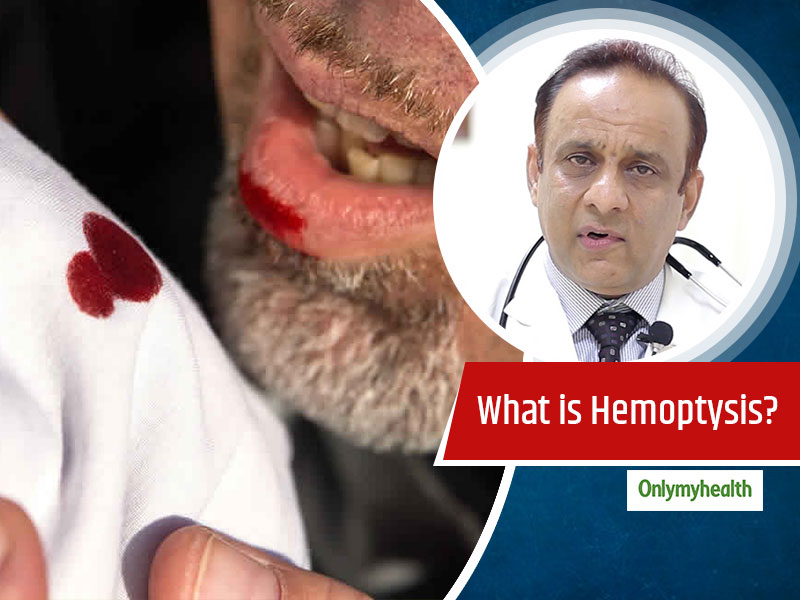 Is Hemoptysis or Coughing of Blood A Serious Condition? Know Its Causes and Treatment