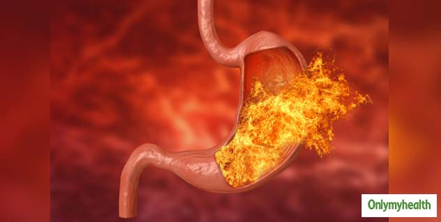 ulcer 