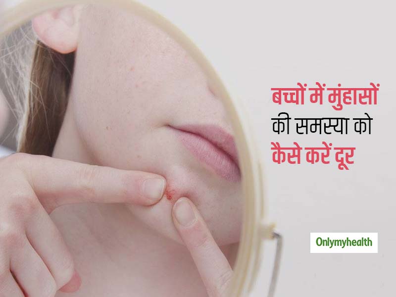 बच्चों के चेहरे पर आने वाले मुंहासों से छुटकारा पाने के लिए अपनाएं ये तरीके, लंबे समय तक त्वचा रहेगी स्वस्थ