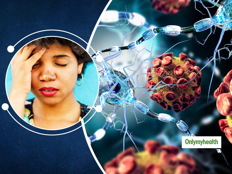 Coronavirus Symptoms: Throbbing Headache Can Be A Neurological Sign Of COVID-19, Says Study