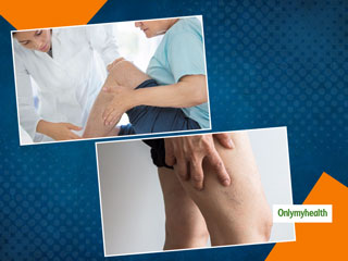 Deep Vein Thrombosis: जानिए क्या है डीप वेन थ्रोम्बोसिस के लक्षण और क्या है इससे बचाव का तरीका