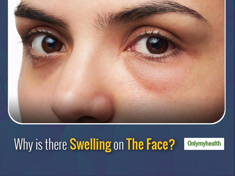 Why Is Your Face Swollen These Could Be The Underlying Problems 