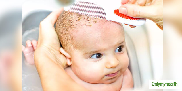 Here Are 6 Tips To Improve Newborn Baby Hair Growth