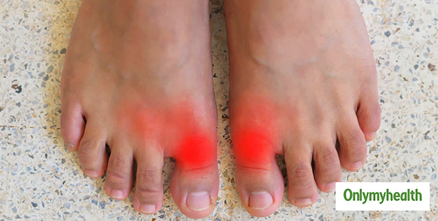 insidecausesofarthritis