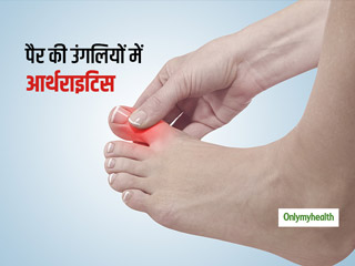 Arthritis Day 2021: पैर की उंगलियों में दर्द व जकड़न हो सकते हैं आर्थराइटिस का संकेत, जानें इसके कारण और लक्षण
