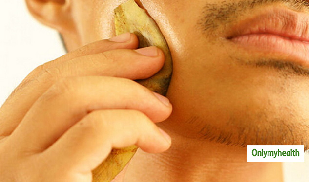 Banana Peel Mask For Hickey