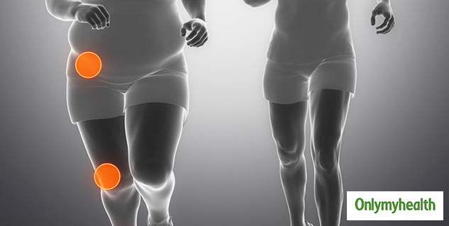 Losing Weight Can Help To Deal Arthritis 
