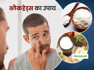 पुरुषों की सख्त त्वचा से ब्लैकहेड्स की सफाई करना नहीं है आसान, इस्तेमाल करें साबूदाना से बनने वाले ये फेस पैक