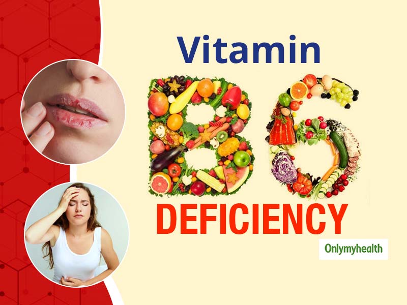 Are You Deficient In Vitamin B6? Watch Out For These Signs of Deficiency