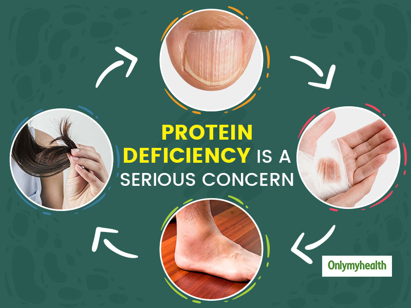 How big is the average protein?