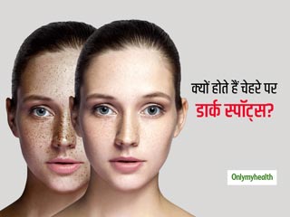 इन 3 कारणों से होती है डार्क स्पॉट्स की समस्या, जानें इससे बचाव के लिए खास स्किन केयर टिप्स