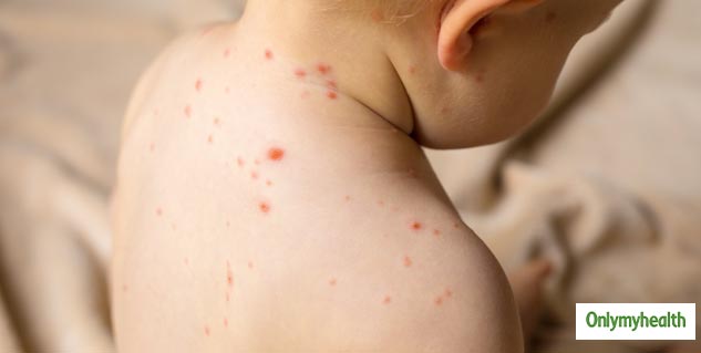 skin diseases in children