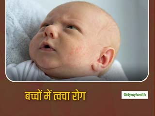 बच्चों में 5 प्रकार के त्वचा संबंधी समस्याएं, जिनके बारे में माता पिता को पता होना चाहिए