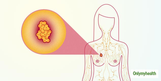 insidebreastcancersymptoms