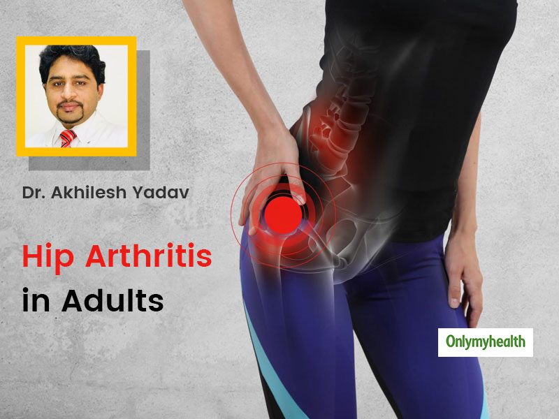 Stiff and Aching Hips? You May Have Hip Arthritis