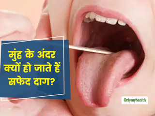 मुंह के अंदर क्यों हो जाते हैं सफेद पैचेज? जानें इन्हें दूर करने के लिए आसान घरेलू उपाय