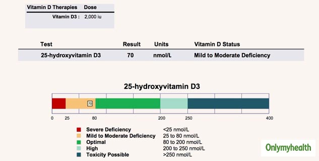 Excess Vitamin D Intake Is Harmful To Your Health, Know All About