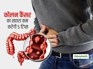 युवाओं में तेजी से क्यों बढ़ रही है कोलन कैंसर की समस्या, जानें इससे बचाव के लिए 6 सबसे जरूरी टिप्स