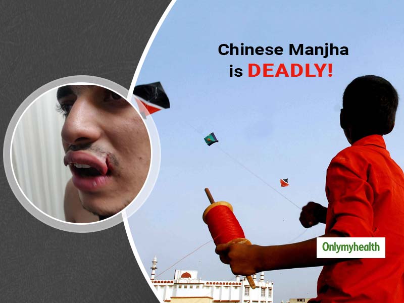 Want To Know How dangerous Chinese Kite Manjha Can Be? Read This Boy's Story