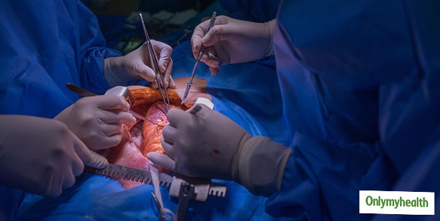 heart transplant surgery need and procedure