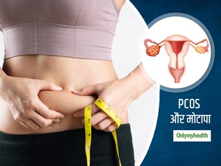PCOS के कारण लगातार मोटी होती जा रही हैं आप? जानें मोटापा कंट्रोल करने का आसान तरीका
