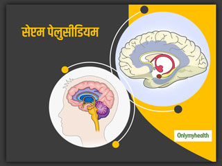 Treatment Of Septum Pellucidum: जानें क्‍या है अब्सेंस सेप्टम पेलुसीडियम के लक्षण और इलाज 