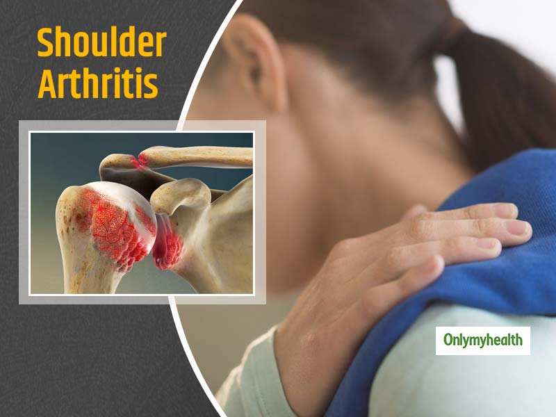 Shoulder Arthritis: What Happens In Shoulder Arthritis And Tips To Manage The Condition