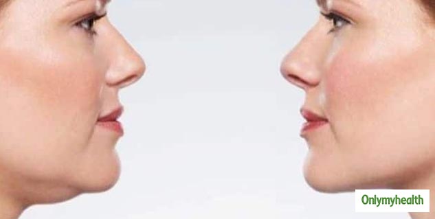 face