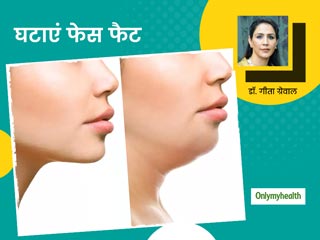 पुरुष हो या महिलाएं चेहरे की सुंदरता बढ़ाती है जॉलाइन, डॉ. गीता ग्रेवाल से जानें फेस फैट कम करने के तरीके   