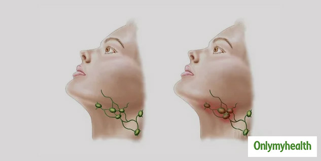 Why Are My Lymph Nodes Swollen In Hindi ज न ल फ न ड स म स जन क क य ह सकत ह प रम ख क रण