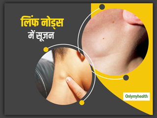 Lymph Nodes Swollen: जानें लिंफ नोड्स में सूजन के क्‍या हो सकते हैं प्रमुख कारण 