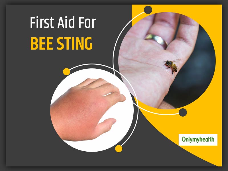 World First Aid Day 2020: First Aid Solutions For A Bee Sting