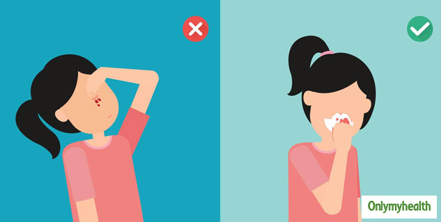 insidenosebleedinghomeremedies