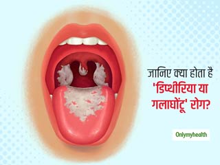 Diphtheria: छोटे बच्चों को होने वाली बीमारी डिफ्थीरिया (गलघोंटू) क्या है, जानें इसके लक्षण और इलाज