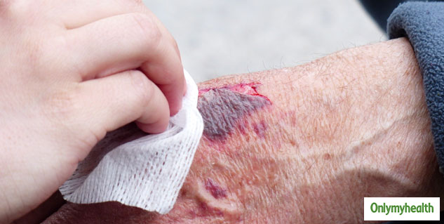 world first aid day 2020