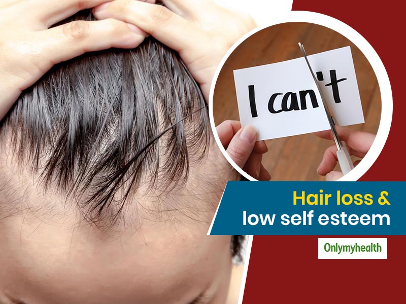 Low Self Esteem Due To Hair Loss? Know-How The Hair Is Connected With  Confidence