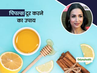 पिंपल्स को चेहरे से गायब कर देगा मलाइका अरोड़ा का ये नुस्खा, जानें दालचीनी को इस्तेमाल करने के 3 और खास तरीके