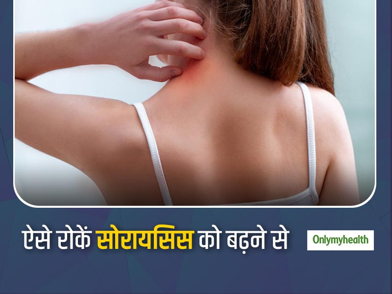 सोरायसिस का कारण बन सकती हैं ये आपकी खराब आदतें, जानिए Psoriasis को बढ़ावा देने वाले 10 कारक