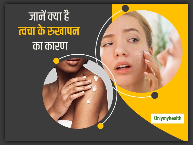 Dry Skin: इन कारणों से आपकी त्वचा होती है रुखी और बेजान, जानें कैसे बनाएं रखें त्वचा में नमी 
