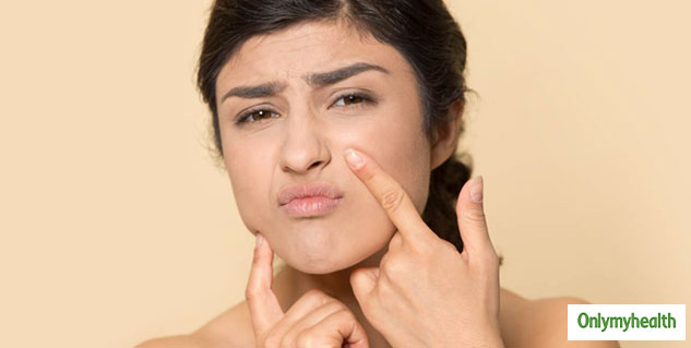 dry skin