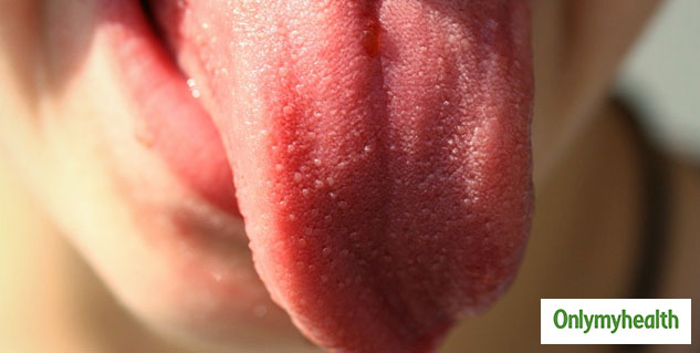 tongue