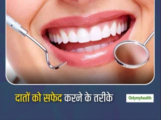 दांतों के पीलेपन से आप भी हैं परेशान? तो आज से इन तरीकों को अपनाएं और पाएं सफेद चमकदार दांत