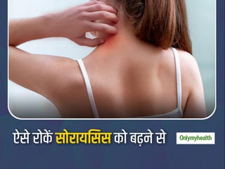 सोरायसिस का कारण बन सकती हैं ये आपकी खराब आदतें, जानिए Psoriasis को बढ़ावा देने वाले 10 कारक