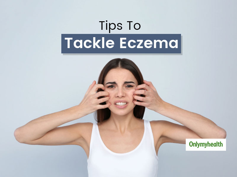 Doctor-Verified Tips To Manage Eczema Breakouts That Happen Due To ...